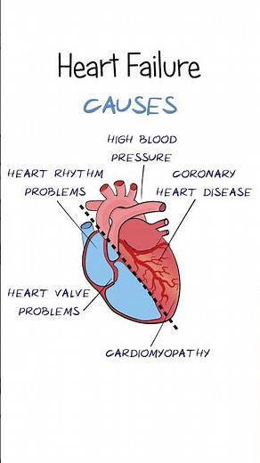 What is Heart Failure?