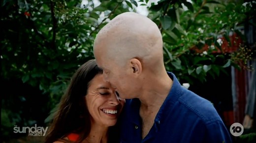 150K views · 2K reactions | Tom Long is one of our favourite home-grown actors- star of The Dish, SeaChange and Two Hands. But he’s currently off the screen and in the fight of his life. | The Project | Facebook