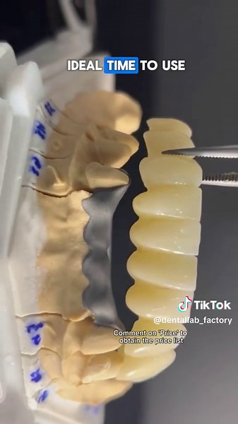 Crown Solutions: Partial Titanium and Ceramic Combination