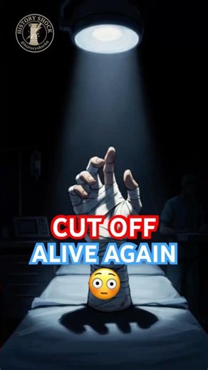 Reattached Hand: Surgeons tried what most believed was impossible