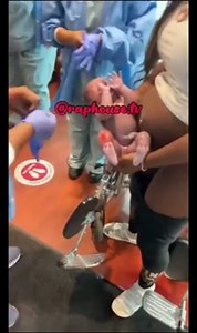 Woman gives birth standing up in the hospital lobby [NSFW]