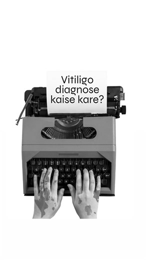 Dr Nitika Kohli | MD Ayurveda on Instagram: "Vitiligo ka diagnosis guesswork nahi hota. Aur na hi har case mein zyada tests ki zarurat hoti hai. 👉 In Vititalk – Episode 1, I explain the 3 ways vitiligo is diagnosed in clinical practice: • Naked eye examination • Wood’s lamp • Skin biopsy (only in selected cases) Vitiligo is a journey. Understanding comes before medicine. Comment CLARITY if you need more answers"