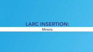 LARC Insertion: Mirena