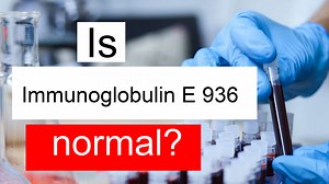 Is Immunoglobulin E 936 high, normal or dangerous? What does IgE level 936 mean?