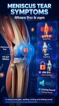 What Is a Meniscus Tear? 🦵 | Symptoms, Causes & Treatment Explained | SyscoCare