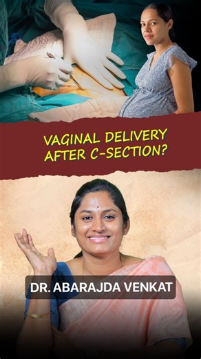 Dr Abarajda Venkat on Instagram: "Criteria for VBAC (Vaginal Birth After Caesarean) 1. Type of previous scar • Only low transverse (LSCS) scar is suitable • No classical / T-shaped / unknown scar type 2. Number of previous C-sections • One previous LSCS – ideal • Two previous LSCS – select cases with strict monitoring • >2 CS – generally not recommended 3. Reason for previous C-section • Non-recurring indications like: • Breech • Fetal distress • Placenta previa (resolved now) • Twin pregnancy (