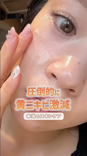 黄ニキビ激減！本当のスキンケア #肌荒れ #ニキビ #スキンケア