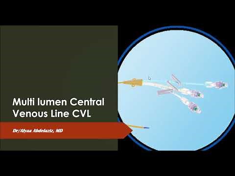 Multi-lumen Central Venous Catheter