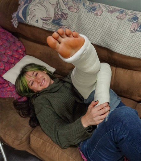 Maru está prestes a sair para o público de muletas com uma LLC de 90° e um LAFS e se alguém pode se locomover assim, é ela. Nós a encontramos no sofá com uma linda pedicure vermelha e uma pintura muito chique em seu dedão do pé. Ela imediatamente cobre os dedos dos pés com algumas meias azuis felpudas, depois puxa a manga para baixo sobre o braço e o jeans para baixo sobre o gesso da perna. Isso foi filmado quando estava quente lá fora, então Maru fica bastante suada com essa roupa com toda a at