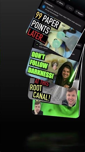 Dental Obturation Precise Techniques for Root Canal Filling