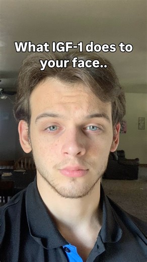 Joshua Allard on Instagram: "🔥 IGF-1: Aesthetic Secret Weapon ✨ IGF-1 (Insulin-Like Growth Factor-1) is a powerhouse for growth, repair, and structural aesthetics — especially bone density and facial definition. 🌟 Why IGF-1 Matters ✨ 1. Better Facial Bone Density Supports stronger cheekbones, jawline, and orbital structure for a sharper look. ✨ 2. Improved Skin Quality Boosts collagen → firmer, smoother, more youthful skin. ✨ 3. Faster Recovery & Lean Mass Enhances muscle tone, posture, and sy