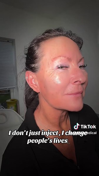 Full Facial Transformation Through Medical Aesthetics