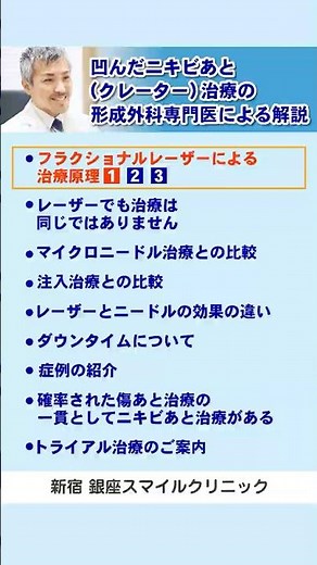 凹んだニキビあと治療の形成外科専門医による解説[1-1]フラクショナルレーザーによる治療原理 #ニキビ跡 #クレーター #美容