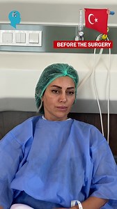 3.9K views · 52 reactions | Deep Brain Stimulation for Head Tremor...