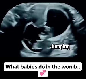 76K views · 2.9K reactions | Babies in the womb are human. They show us with their own behavior! | Dr. Abby Johnson | Facebook