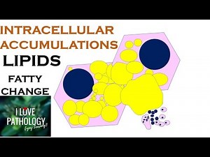 INTRACELLULAR ACCUMULATIONS: LIPIDS- Fatty Change