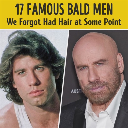 1.7M views · 12K reactions | 17 Famous Bald Men We Forgot Had Hair at Some Point | Smart is the New Sexy | Facebook