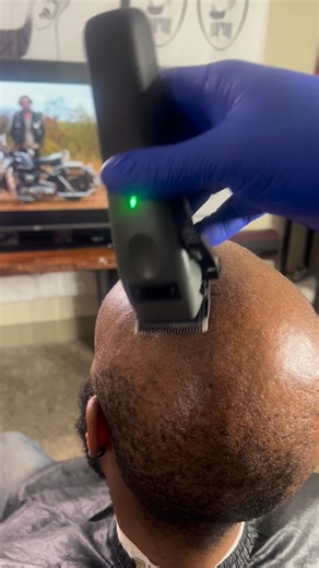 Scalp Micropigmentation DFW on Instagram: "Scalp Micropigmentation “SMP” can take away that receding hairline look and give you the appearance of a low fade , fresh out of the Barbershop look, or a buzz cut look without the Barbershop line up. Immediate results! On average it will take 2 to 3 sessions for your desired look. Once again……….Get it done right the first time at DFW Scalp Ink. With over 20 years of experience in the Hair industry, you will not regret making this decision. Call or text