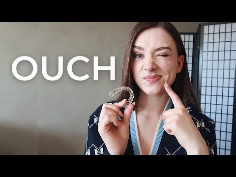 The Most Painful Part of My Invisalign Jouney