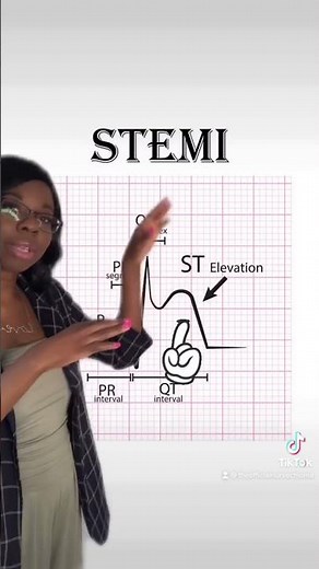 How To Read EKG Rhythms!