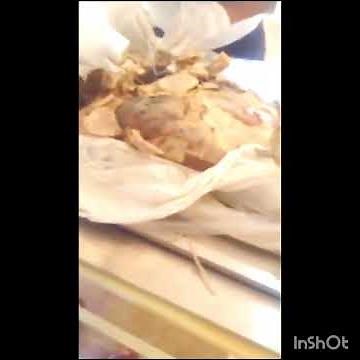 Dissecting Human Heart