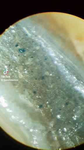 Clean Your Shrimp or Prawns Before Eating – Microbes and Brownian Motion