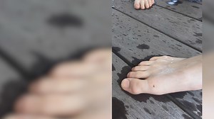 Lake Lanier: Leeches latching onto swimmers in droves