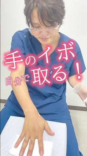 【手のイボを自分で取る！】#shorst #イボ