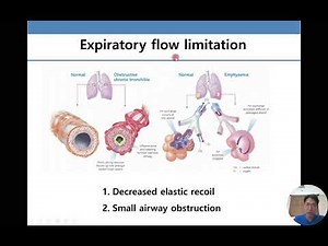 폐기능 검사의 이해와 해석 (Pulmonary function test)