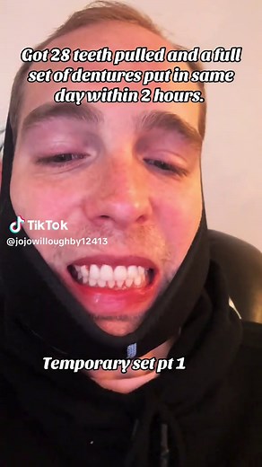 Affordable Dentures: Quick Full Mouth Extraction Success