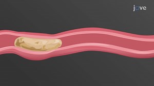 Video: Functions of Smooth Muscles