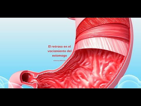 Retraso en el vaciamiento gastrico o Gastroparesis