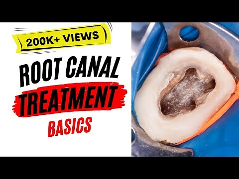 Root Canal Treatment Basics | Step-by-Step