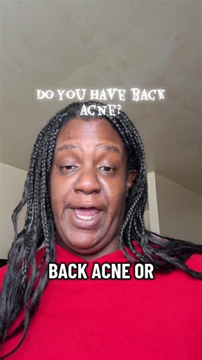 Back acne #Acne #BackAcne #Pimples #Zits #SkinCare