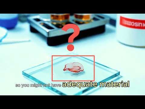 Dr. Venkatraman Radhakrishnan | Head, Medical Oncology | Cancer Institute (WIA) | ICGA 2025 Message