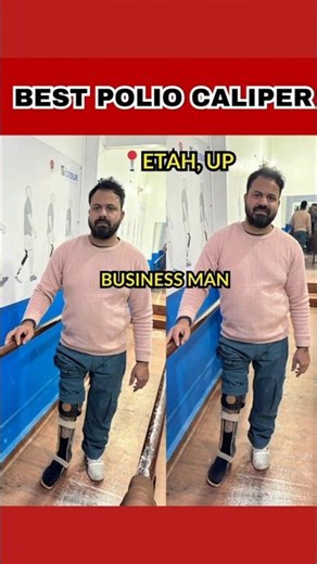 Best Caliper For Your Legs #prostheticlimb #bornlife #caliper #poliocaliper #shortvideo #ytshorts