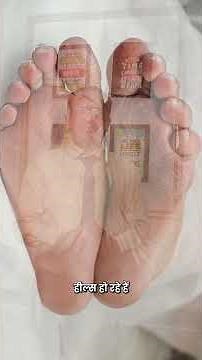 Diabetic Ulcer & Diabetic Neuropathy – Do Not Ignore Foot Symptoms