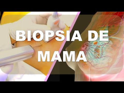 Breast Biopsy: Techniques
