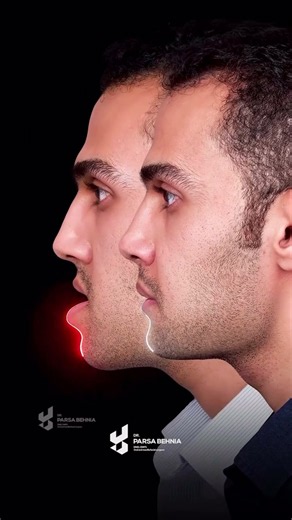 😱 Essa Transformação Impressiona! | Dr. Parsa Behnia, cirurgia bucomaxilofacial, inscreva-se!