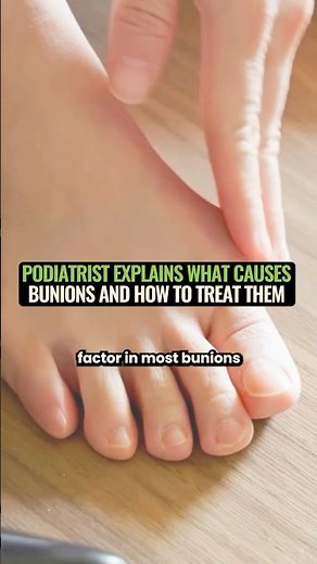 The Real Cause Of Bunions 👟 Podiatrist Explains (See Description)