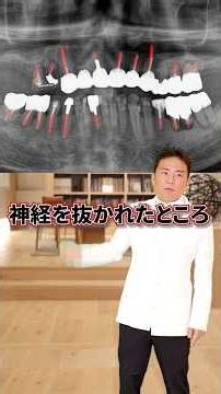 一見綺麗だが、歯周病が進行してしまった時の選択肢とは