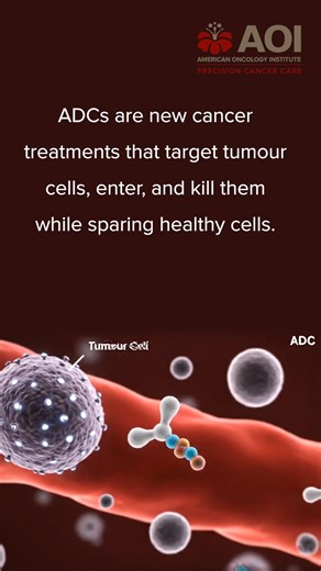 2.3K views · 41 reactions | Antibody-Drug Conjugate (ADC) is changing the way we fight cancer. Watch the video to learn from our expert on how precision medicine is shaping the future of cancer care. #CancerTreatment #ADCTherapy #ADCTreatment #AntibodyDrugConjugate #PrecisionMedicine #HopeInAction #AmericanOncologyInstitute #AOICancerCare #WeJourneyWithYou | American Oncology Institute | Facebook