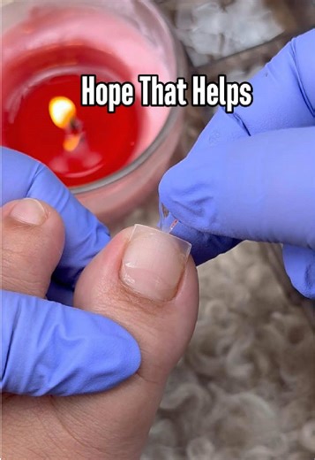 Say Goodbye to Broken Toenails with DIY Nail Art Tips