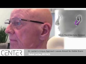 Micro Parotidectomy Surgery | Babak Larian, MD, FACS