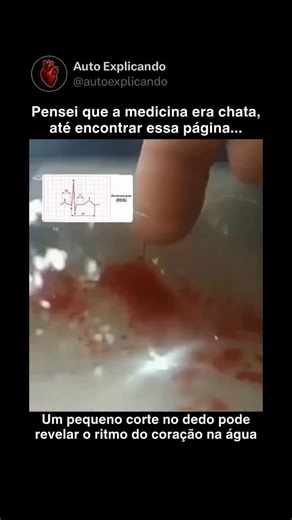 Auto Explicando | Saúde | Curiosidades on Instagram: "Quando você mergulha um dedo sangrando na água, pode notar que o sangue sai do ferimento em jatos pulsantes que acompanham os batimentos do seu coração. O sangue circula sob pressão: o coração cria pressão dentro dos vasos sanguíneos (é isso que chamamos de pulso). A cada batimento, uma porção de sangue é impulsionada para frente. Pulsação: quando o dedo é cortado e capilares ou pequenos vasos são danificados, essa pressão faz com que o sangu