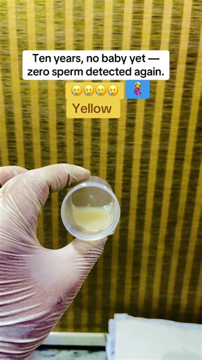 Understanding Sperm Analysis and Fertility Challenges