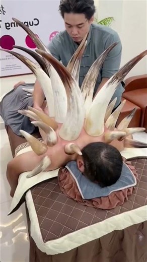 What is cup therapy? 🫩 #shorts