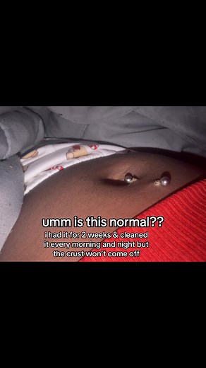 Belly Piercing Care: How to Clean and Heal Effectively