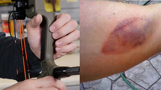 Why The Bow String Hits Your Arm