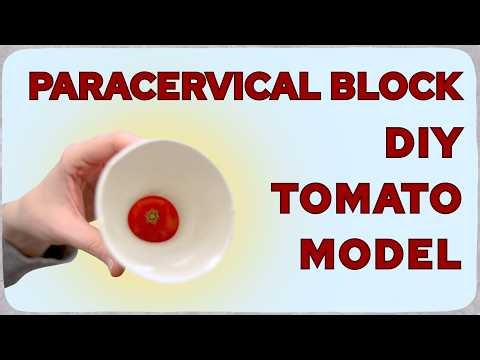Creating a DIY Tomato Model for Paracervical Block Training for Gynecologic Procedures